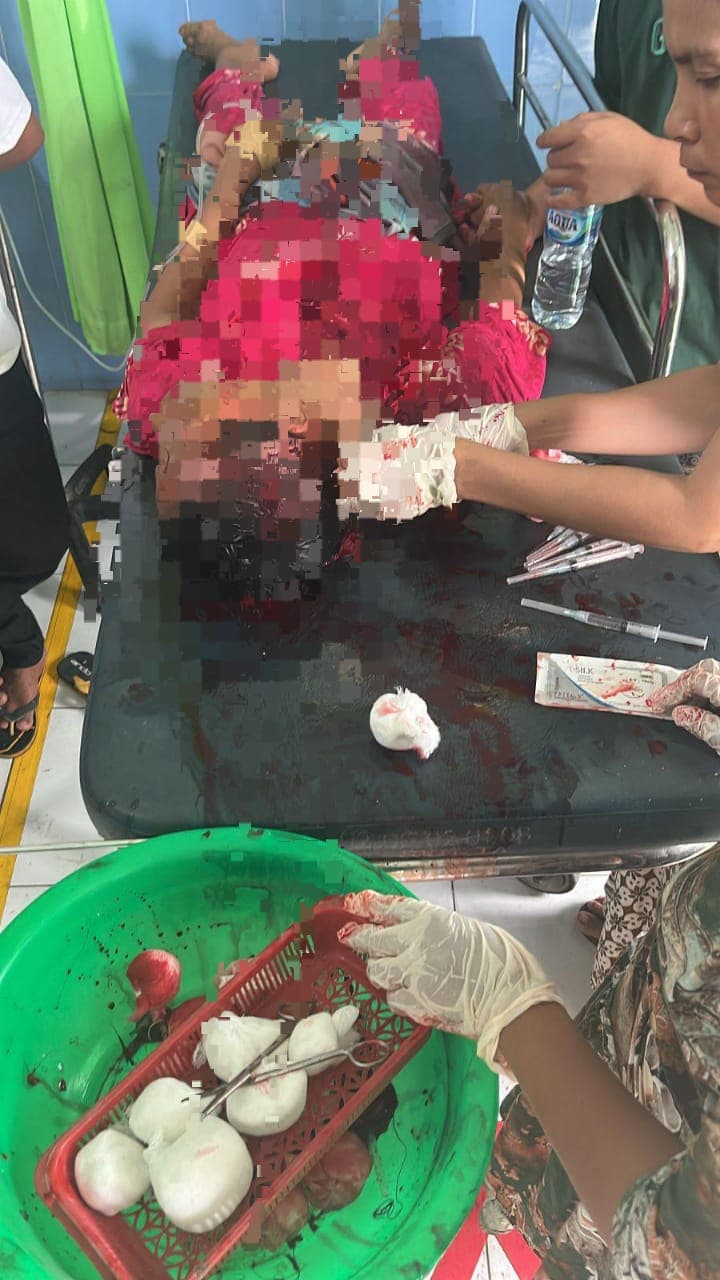 Pembunuhan Sadis di Aceh Tenggara,  5 Orang Tewas, 1 Luka Berat,  Polres Agara Buru Pelaku