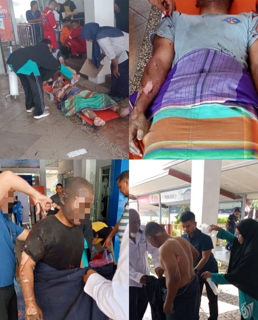 Ledakan di Kamar Mesin KMP Aceh Hebat 2, Belasan Korban Dilarikan ke RSZA