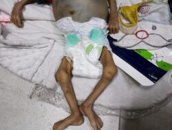 Dokter Ceritakan Ngerinya Kondisi Warga Termasuk Anak-anak di Gaza yang Kelaparan